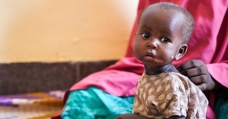 unicef-calls-on-g7-to-help-tackle-global-child-malnutrition-crisis