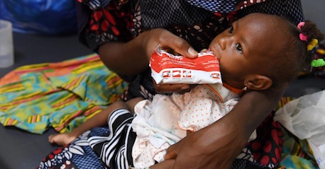 as-malnutrition-rates-soar-in-burkina-faso,-unicef-steps-up-assistance