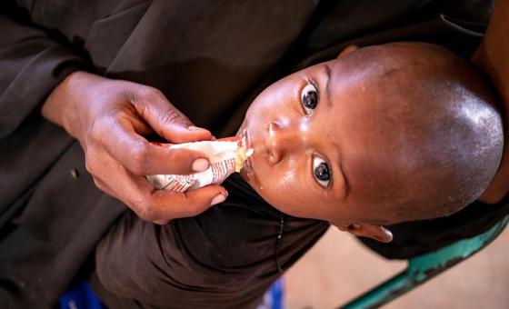 somalia:-unicef-warns-of-unprecedented-child-deaths