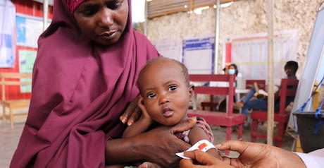 with-somalia-on-brink-of-famine,-more-children-at-risk-of-dying