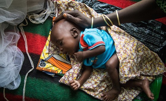 horn-of-africa:-over-7-million-children-under-the-age-of-5-remain-malnourished